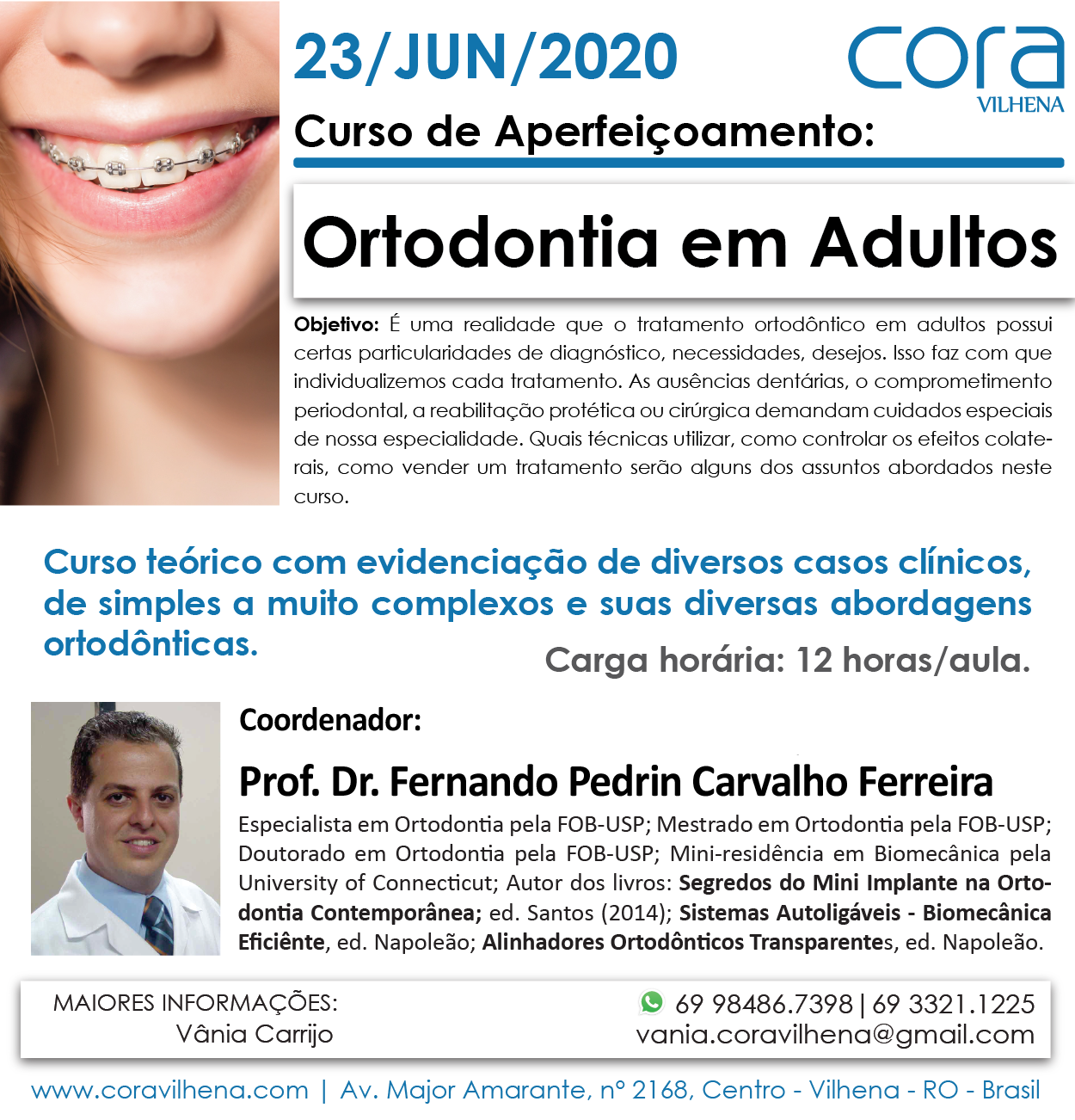 Ortodontia em adultos